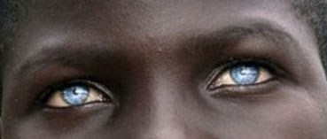 Blue eyes